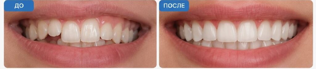 случай1