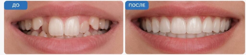 Случай2