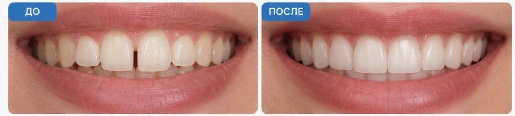 Случай3
